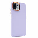 Funda Xiaomi Mi 11 Lite Golden Lens